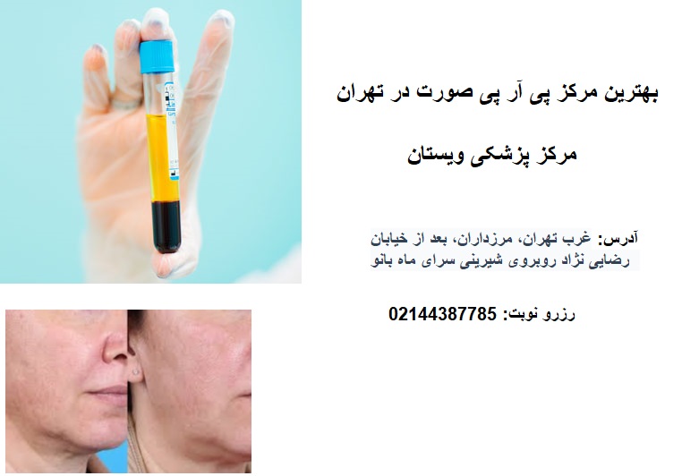 بهترین مرکز پی آر پی صورت در تهران