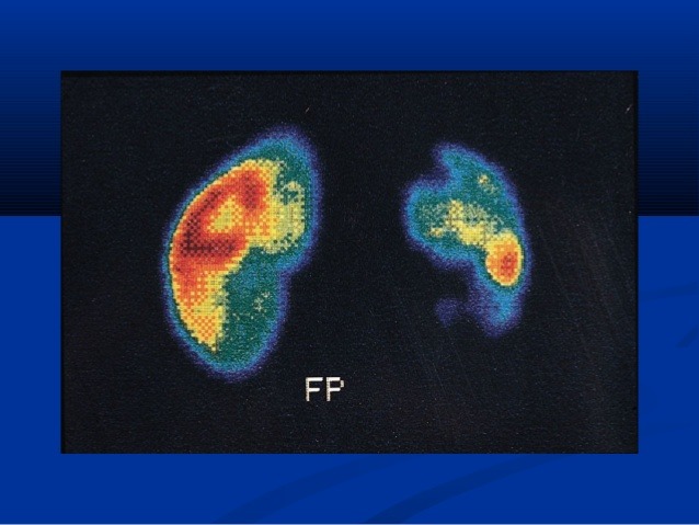 اسکن DTPA اسکن DTPA چیست