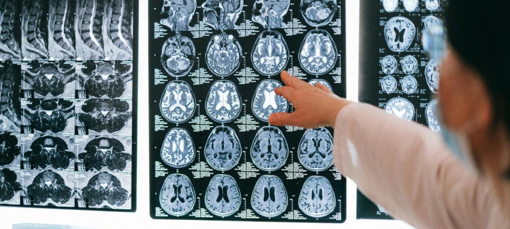 تفسیر دقیق جواب سی تی اسکن تفسیر جواب سی تی اسکن به زبان ساده