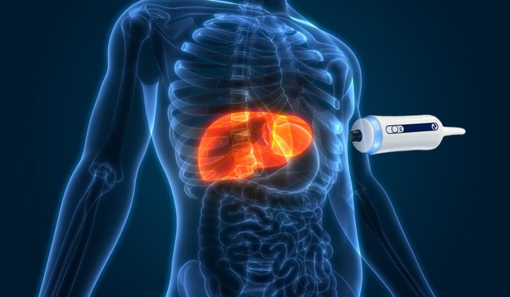 معرفی مراکز معتبر فیبرو اسکن کبد