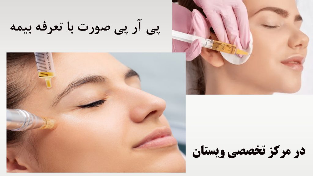 هزینه پی آر پی صورت