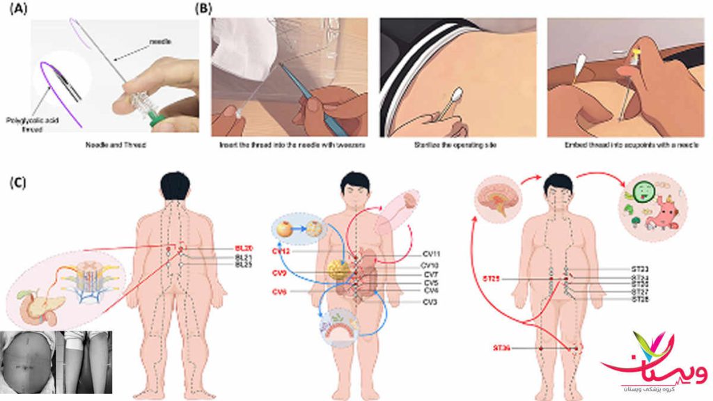 اهمیت انتخاب بهترین دکتر امبدینگ اهمیت انتخاب بهترین دکتر امبدینگ