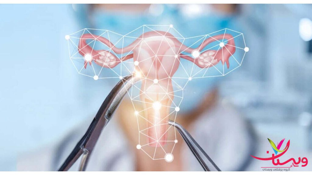 هزینه عمل فیبروم رحم هزینه عمل فیبروم رحم