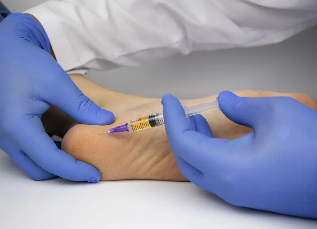 مرکز تزریق آمپول خار پاشنه تصویر تزریق آمپول کورتون برای درمان خار پاشنه