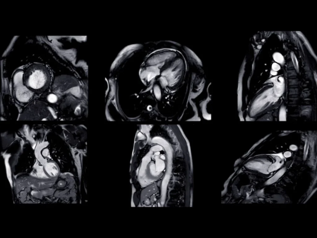 بهترین مرکز ام آر آی قلب راهنمای انتخاب مرکز MRI قلب با قیمت مناسب