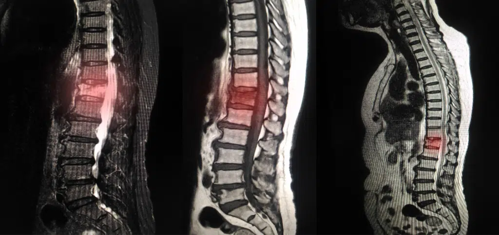 هزینه MRI کمر عوامل موثر بر هزینه MRI کمر چیست