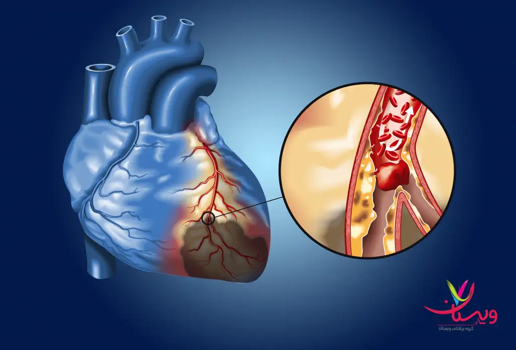 تشخمیص بیماری ها در اسکن قلب نمایش دستگاه اسکن قلب