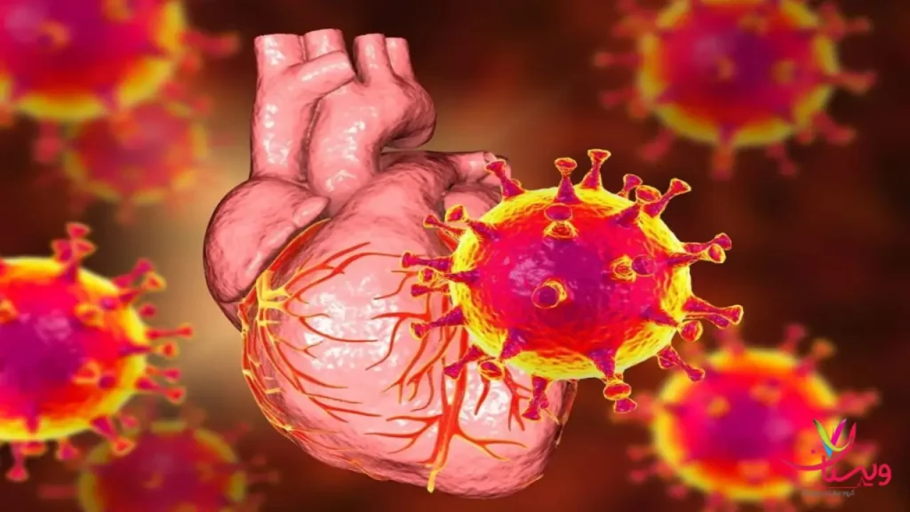 اسکن قلب و مشکلات ان بیمار در حال انجام اسکن قلب