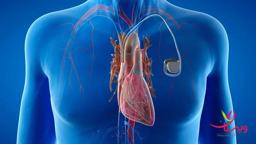 عوارض اسکن قلب مانیتور نتایج اسکن