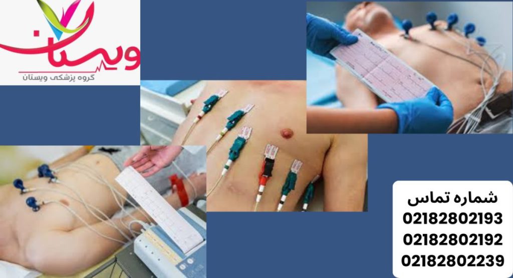 تست نوار قلب | راهنمای جامع برای تشخیص و پیشگیری از بیماریهای قلبی1404