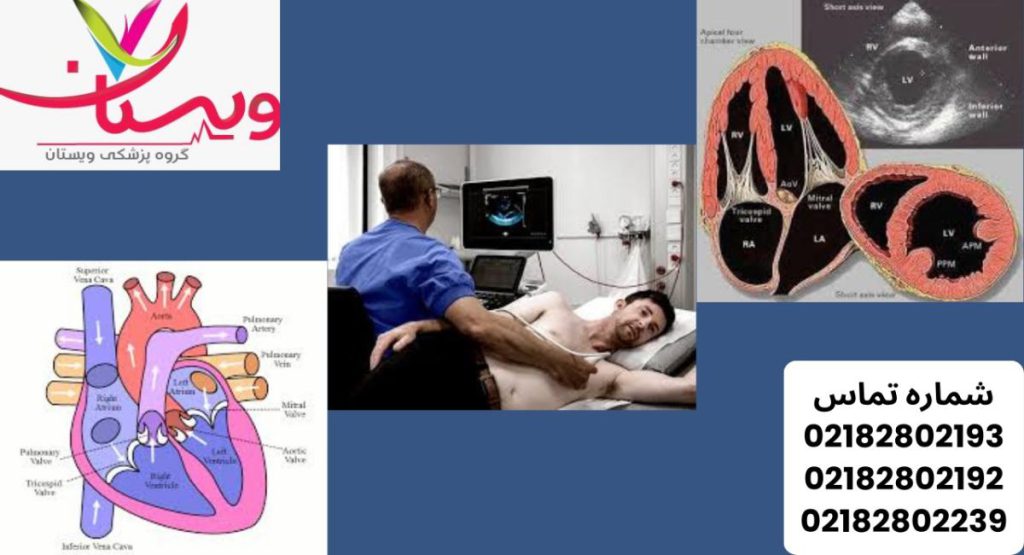 چه زمانی اکو قلب لازم است؟