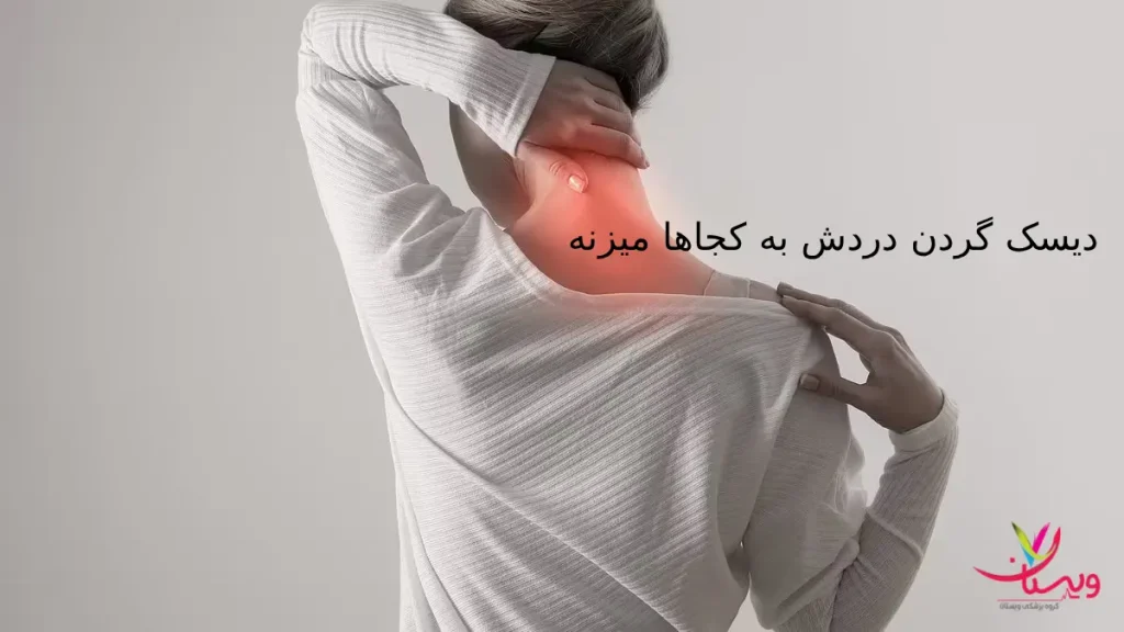 دیسک گردن دردش به کجاها میزنه؟ |شایع ترین علائم دیسک گردن
