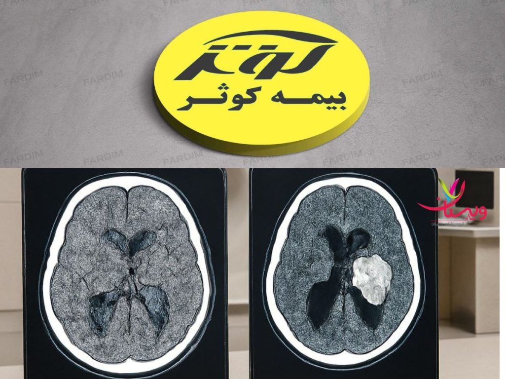 اسکن مغز و ام آر ای با بیمه مراکز ام آر آی طرف قرارداد بیمه کوثر تهران