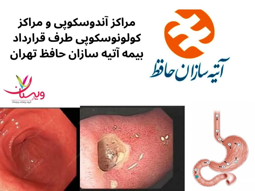 آندوسکوپی و کولونوسکوپی با بیمه آتیه مراکز آندوسکوپی و مراکز کولونوسکوپی طرف قرارداد بیمه آتیه سازان حافظ تهران
