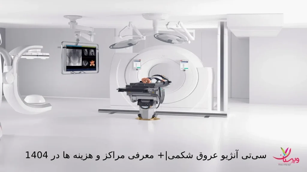 سیتی آنژیو عروق شکمی|+ معرفی مراکز و هزینه ها در 1404