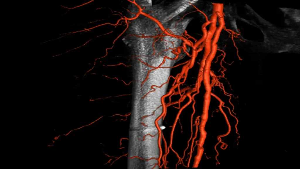 تجهیزات پیشرفته مرکز ویستان برای سیتی آنژیو عروق شکمی