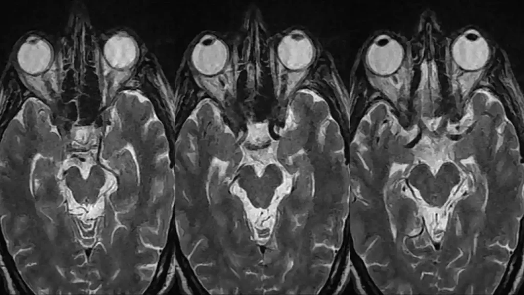 سودو اسکن هزینه سودو اسکن در کلینیک ویستان