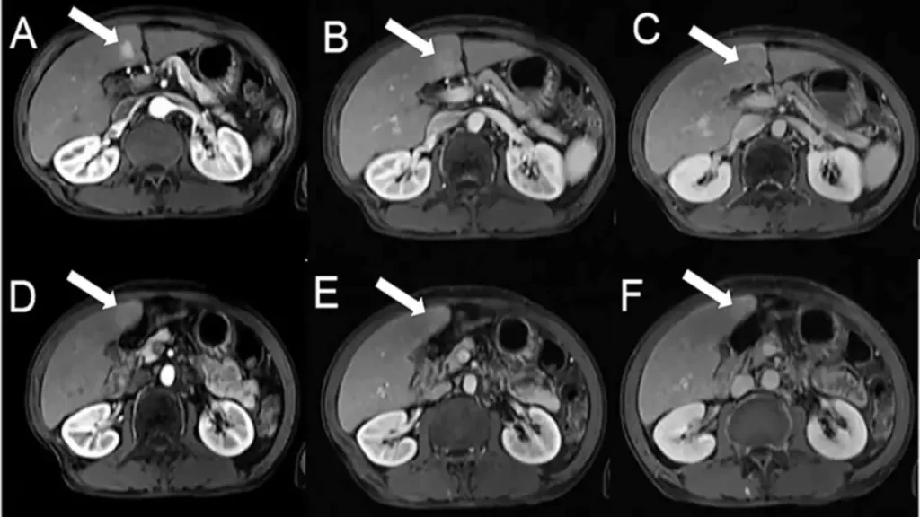 سودو اسکن مغز عوامل مؤثر بر هزینه سودو اسکن