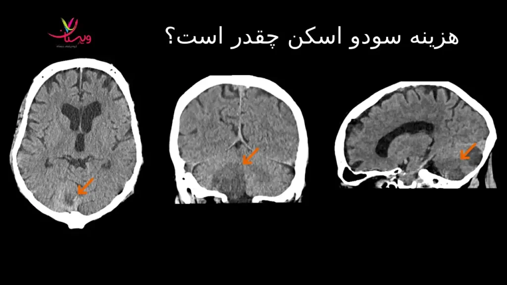 هزینه سودو اسکن چقدر است؟ تعرفه کامل در 1404