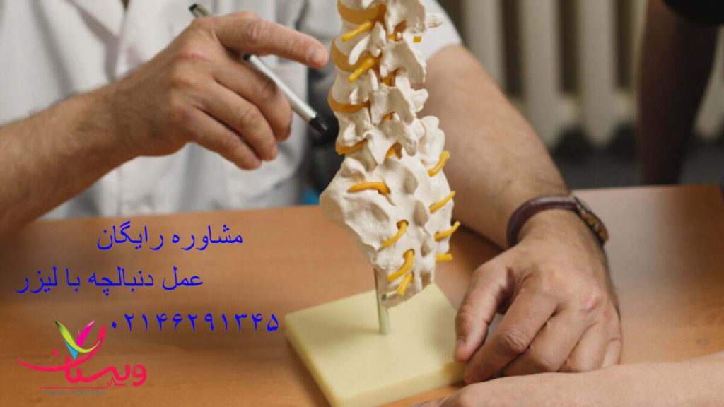 عمل دنبالچه با لیزر کم تهاجمی و موثر عمل دنبالچه با لیزر کم تهاجمی و موثر