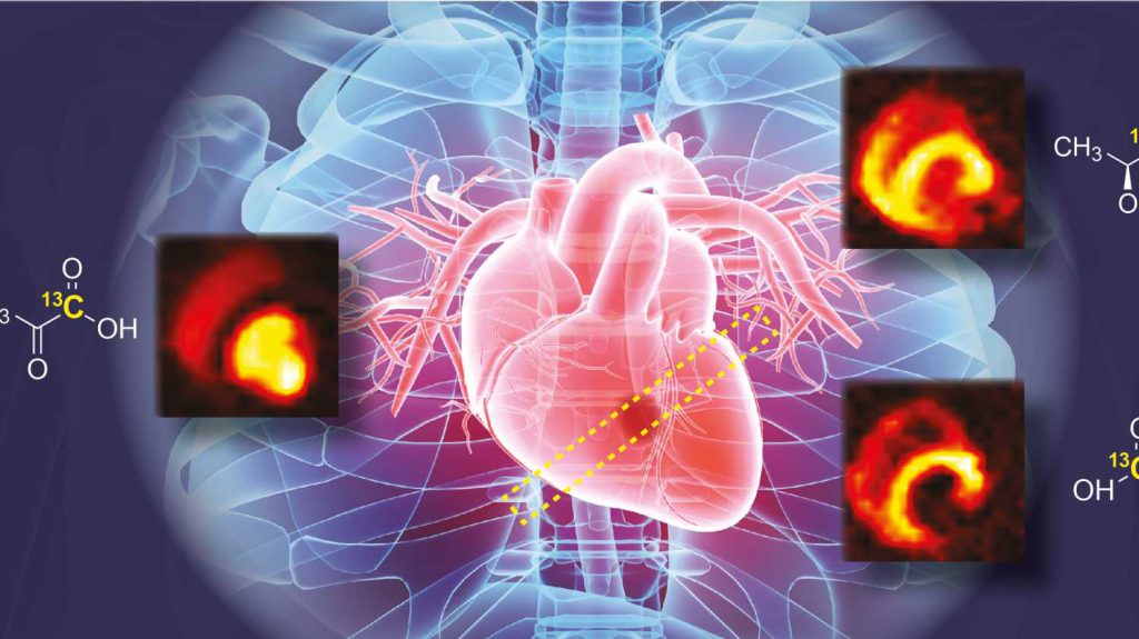 ۵۰ مرکز معتبر اسکن هسته ای قلب در تهران با تجهیزات پیشرفته