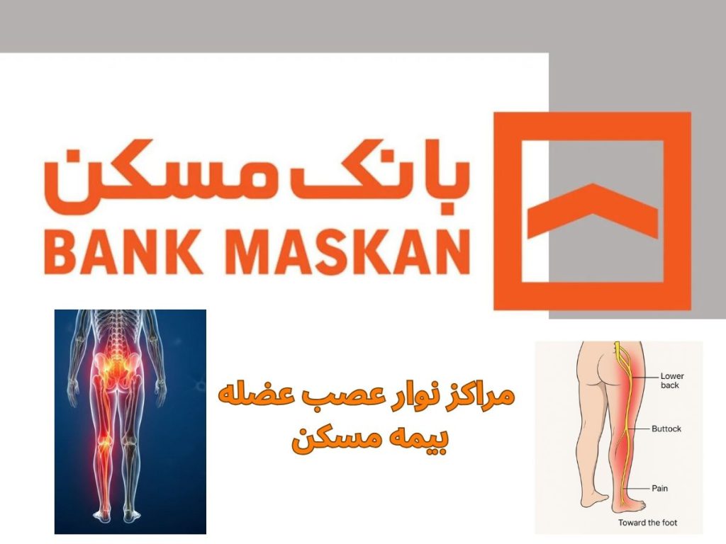 بیمه بانک مسکن برای نوار عصب مراکز نوار عصب عضله بیمه مسکن
