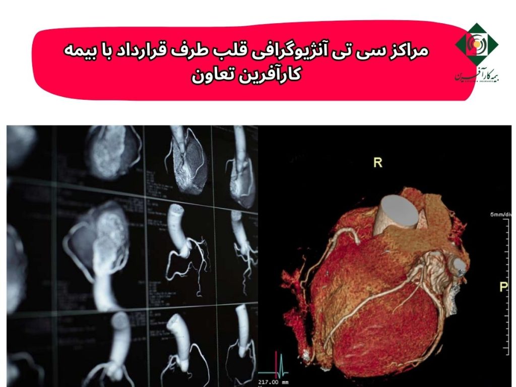 مراکز سی تی آنژیوگرافی قلب طرف قرارداد با بیمه کارآفرین تعاون