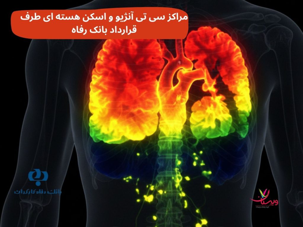 مراکز سی تی آنژیو و اسکن هسته ای طرف قرارداد بانک رفاه