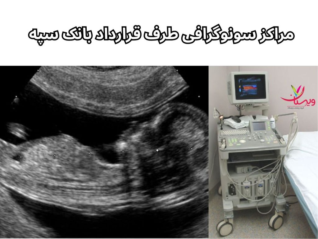 سونوگرافی با بانک سپه مراکز سونوگرافی طرف قرارداد بانک سپه