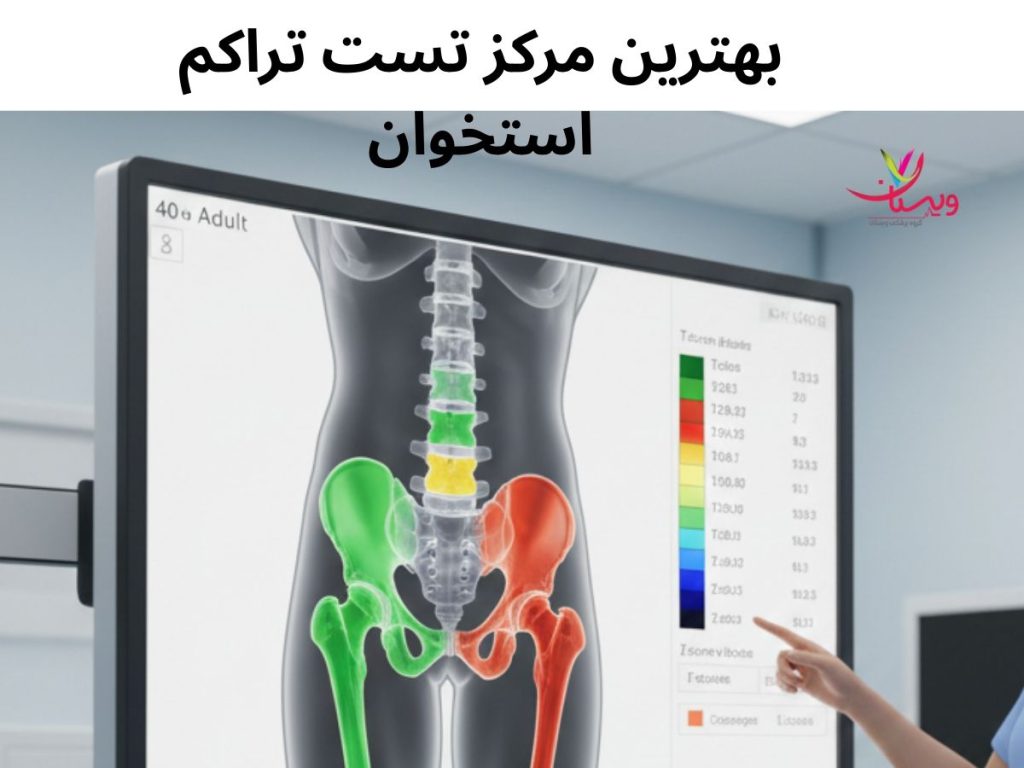 بهترین مرکز تست تراکم استخوان