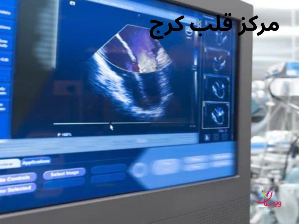 متخصص قلب شبانه روزی در کرج