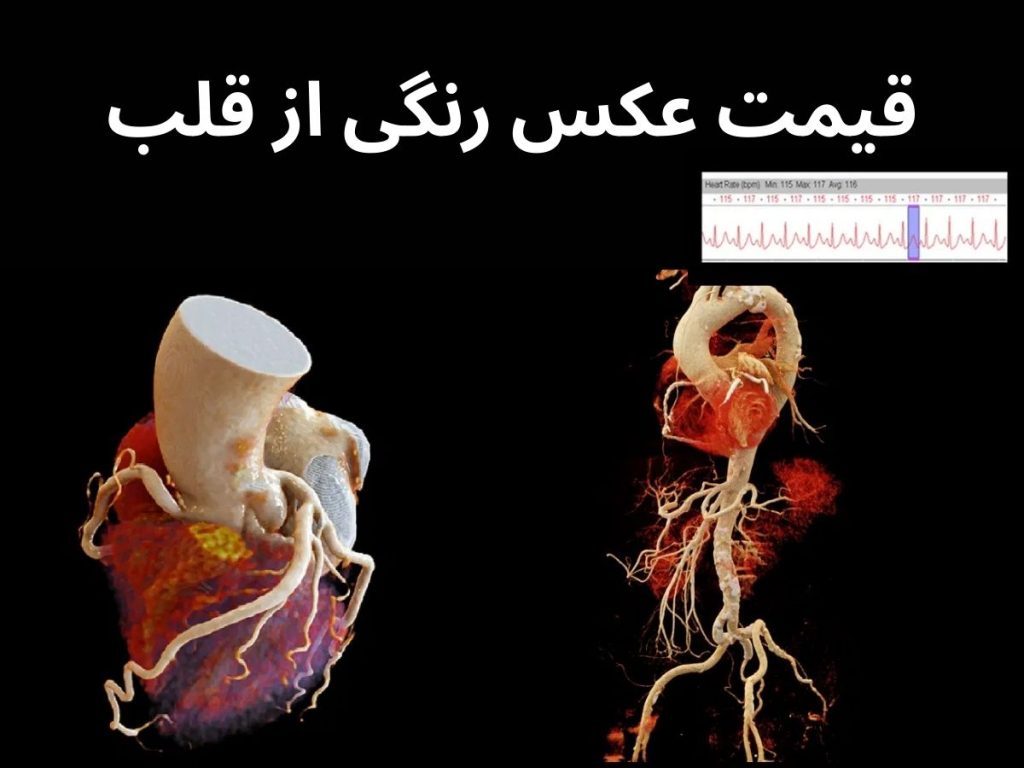 قیمت عکس رنگی از قلب