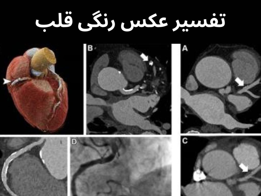 تفسیر عکس رنگی قلب