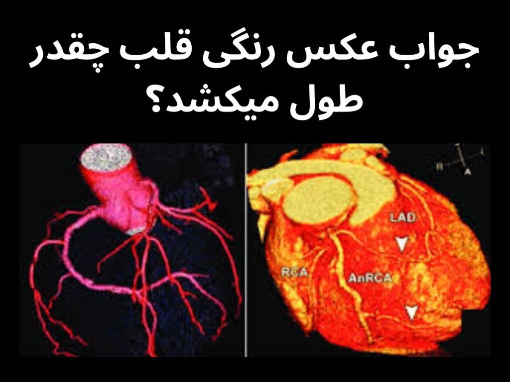 جواب عکس رنگی قلب چقدر طول میکشد؟