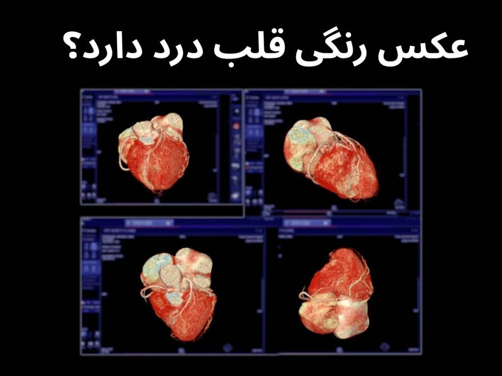 عکس رنگی قلب درد دارد؟
