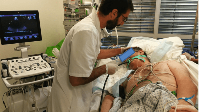 اکو مری قلب چیست؟