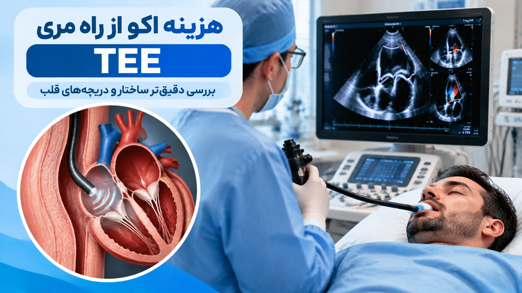 هزینه اکو از راه مری TEE